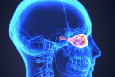 Neuromielite Óptica (NMO): O impacto dos Anticorpos no controle de surtos